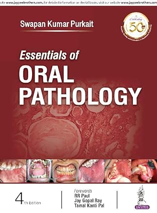 Essentials of Oral Pathology