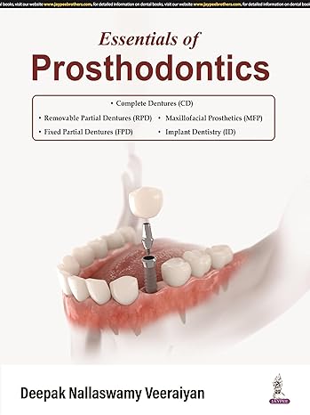 Essentials of Prosthodontics
