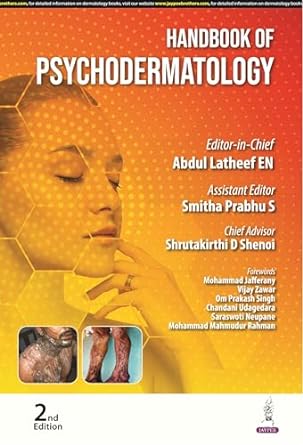 Handbook of Psychodermatology